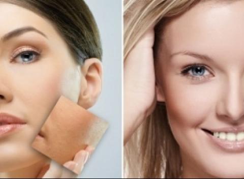 Hoďte akné za hlavu. Liečba akné špeciálnymi lekárskymi prípravkami s bioceutikami. Najúčinejšia metóda na zapálenú pleť, aj na ťažšiu formu akné. Teraz za 21,90 € !