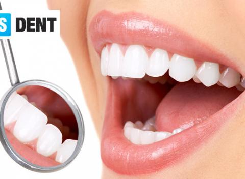Komplexná dentálna hygiena v odporúčanom stomatologickom centre 3S DENT. Zdravý a žiarivý chrup vďaka profesionálnemu prístupu.