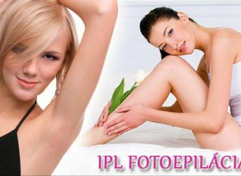 Trvalá IPL epilácia v salóne Vánok. Zbavte sa natrvalo nežiaducich chĺpkov a doprajte si krásne hladkú pokožku!
