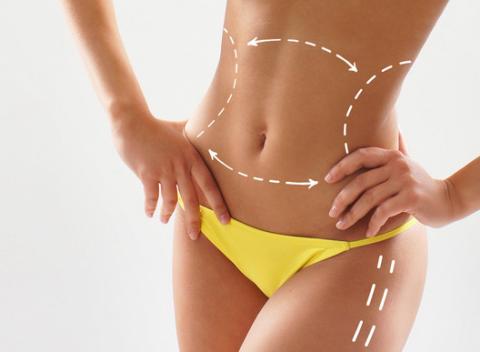 Laserová liposukcia, prístrojová lymfodrenáž a škoricový zábal. Najúčinnejšie metódy v boji proti celulitíde a nežiaducemu tuku. 