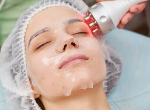 Rádiofrekvencia – vyhladenie a redukcia vrások, spevnenie a omladenie pleti.