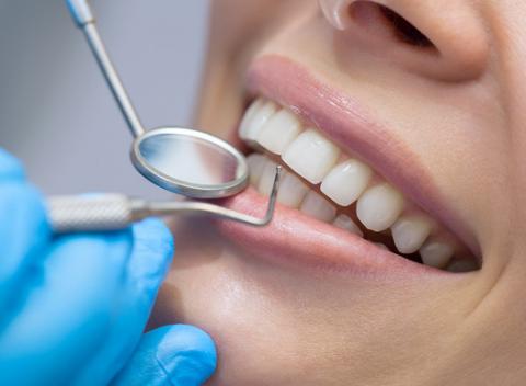 Dentálna hygiena alebo ošetrenie zubného kazu a výmena plomby. Ak sa budete poriadne starať o svoj chrup, odvďačí sa vám zdravím. 