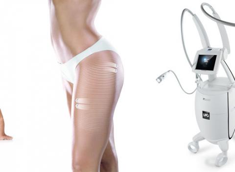 LPG lymfodrenáž pre ľahké a štíhle nohy s francúzskym prístrojom LPG Cellu M6 Integral 2. Ošetrenie s LPG je bezbolestné.