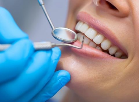 Profesionálna dentálna hygiena - v cene aj preventívna prehliadka, ktorá šetrí financie.