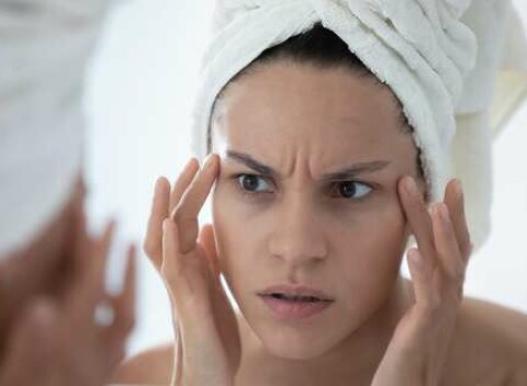 Odstránenie mimických vrások botulotoxinom v salóne L&W beauty