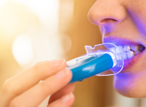 Šetrné a účinné neperoxidové bielenie zubov. V ponuke 30 alebo 60-minútové bielenie.