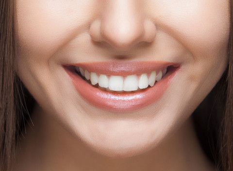 Šetrné a účinné neperoxidové bielenie zubov. V ponuke 30 alebo 60-minútové bielenie.