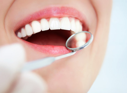 Komplexná dentálna hygiena s fluoridáciou v dentálnom centre Verona v Prešove.