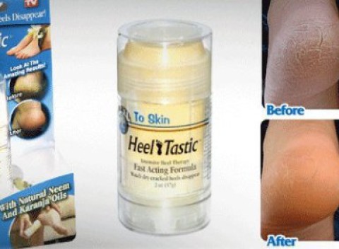 Máte popraskané a zničené chodidlá? Objavte kúzlo liečivého krému - Heel Tastic.