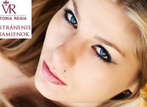 Znamienko krásy? Chirurgické odstránenie znamienok na Klinike Victoria Regia.