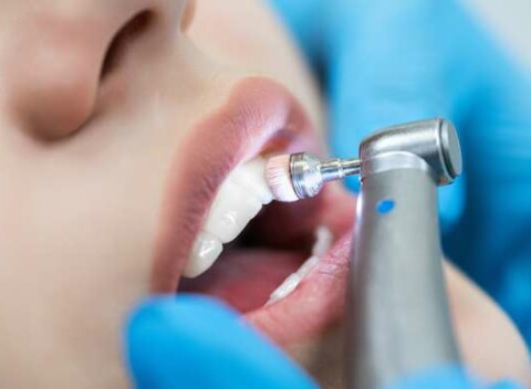 Profesionálna dentálna hygiena, bielenie zubov a ozónoterapia v 24 DENTAL - zubná pohotovosť III.veže