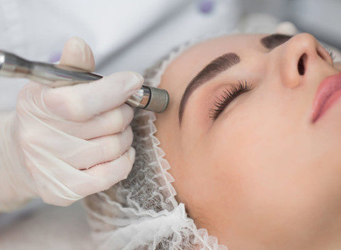 Diamantová mikrodermabrázia - účinná a bezpečná procedúra na omladenie tváre.