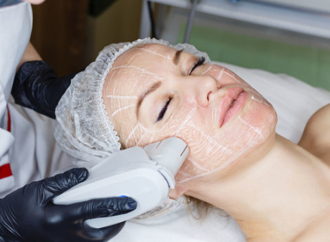 Hifu (Ultherapia) - lifting bez skalpela fokusovanou ultrazvukovou metódou na omladzovanie.