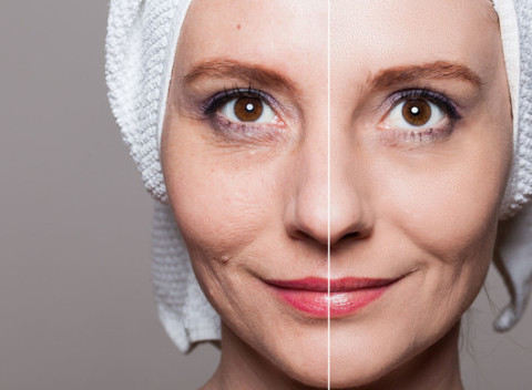 Navždy mladá? Skin Scruber, dermabotexín a odstránenie pigmentových škvŕn.