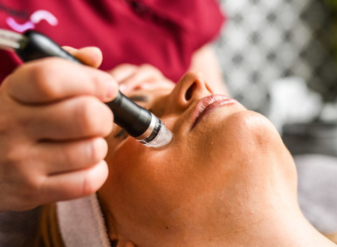 Účinná liečba akné vďaka špeciálnemu ošetreniu v Lumines beauty center.