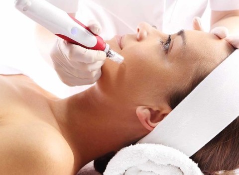 Čistenie pleti alebo špeciálny chemický peeling pre dokonalú pleť v Beauty centrum.