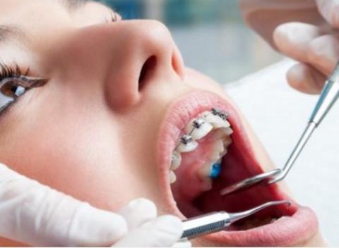 Profesionálna dentálna hygiena s preventívnou prehliadkou bezplatne. Myslite dopredu a nechajte si vyšetriť orálne zdravie.