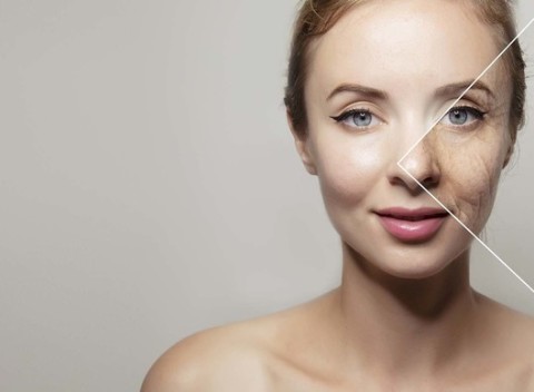 Bezbolestné omladzujúce kolagénové ošetrenie celého tela prístrojom Collagen Plus.