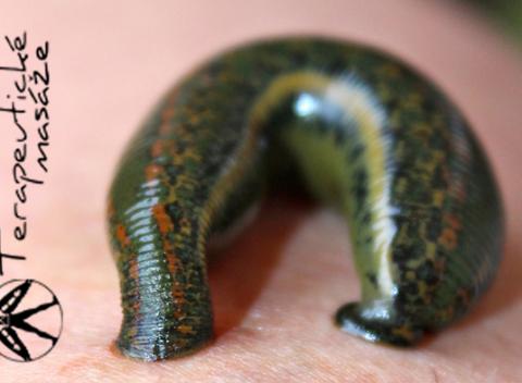 Liečba pijavicou lekárskou - hirudoterapia. Jedinečná terapia používaná už v starovekom EGYPTE vás zbaví mnohých ochorení. 