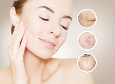 Frakčný Resurfacing - rýchle a efektné omladenie pleti bez použitia skalpelu,