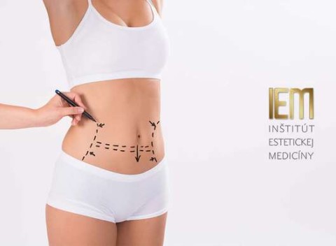Plastická operácia ovisnutého podbruška – miniabdominoplastika v IEM.
