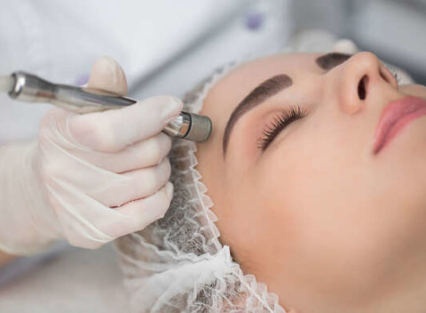 Diamantová mikrodermabrázia - účinná procedúra na omladenie tváre, určená pre všetky typy pleti.